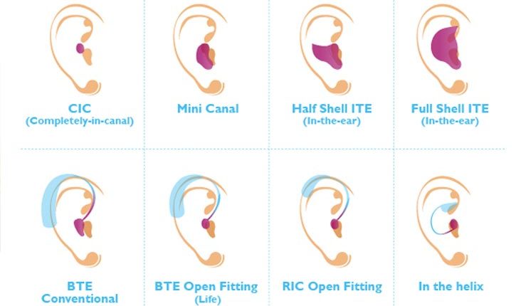 Types of Hearing Aids Introduce